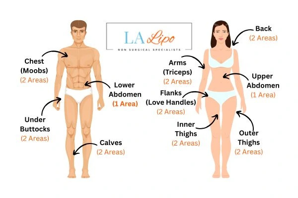 LA LIPO Cryolipolysis Areas Chelmsford