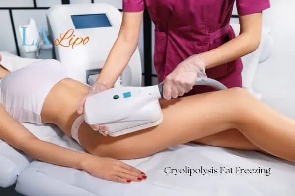 Woman receiving coolsculpting Chelmsford treatment on her thighs