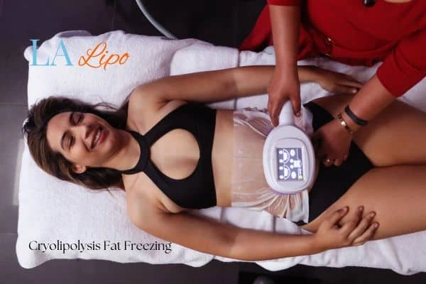 woman getting cryolipolysis Chelmsford