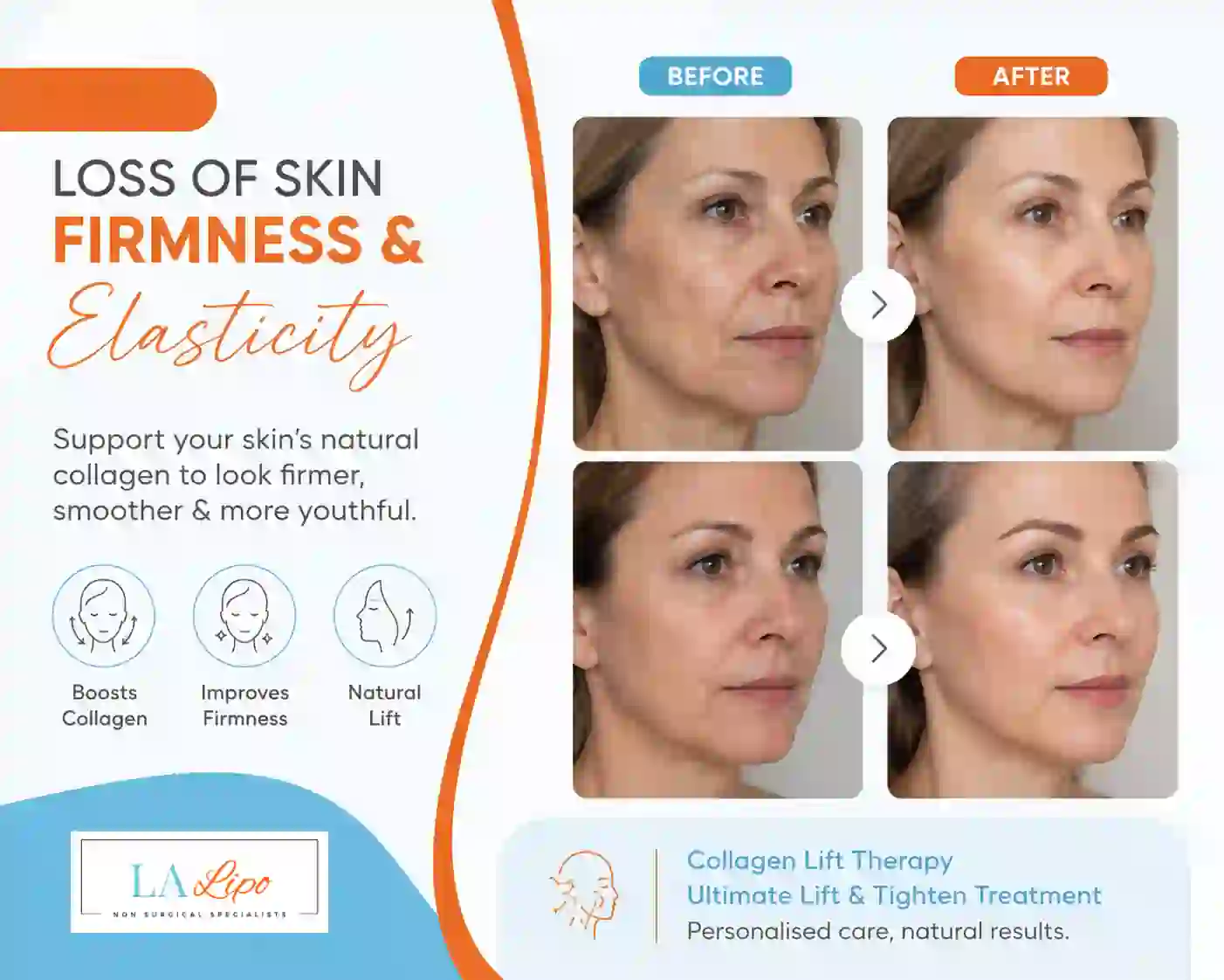 Sign #7: Loss of Skin Firmness and Elasticity Chelmsford